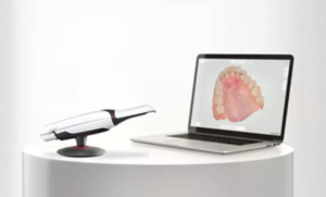 TRIOS digital intraoral scanner used for digital impressions in Newport Beach