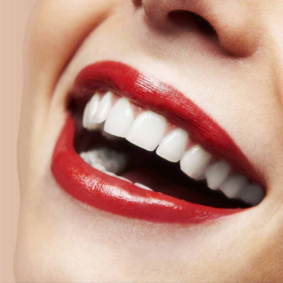 Dental Veneers Newport Beach Dental Studio