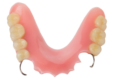 Immediate temporary partial denture after dental extraction