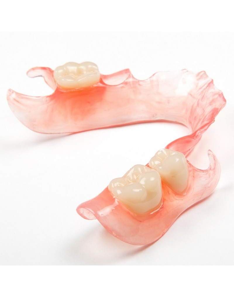 Metal-free flexible partial denture in Newport Beach