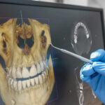 KaVo cone beam CT 3D dental imaging at Newport Beach Dental Studio