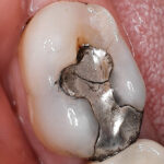 High-resolution intraoral dental photography at Newport Beach Dental Studio